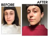 Person’s face before and after using SkinCeuticals C E Ferulic