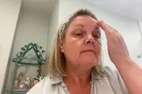 Person rubbing serum into their forehead