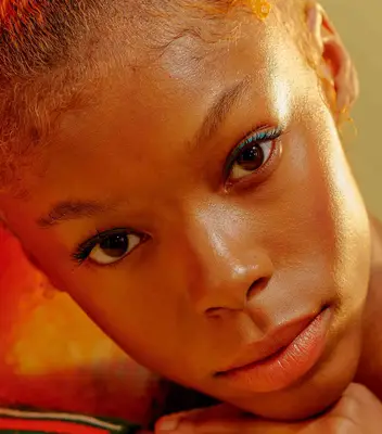 Woman with an oily t zone 