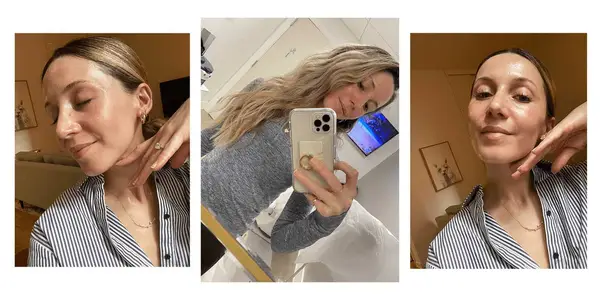 MYM Beauty writer Laura Lajiness shows off the results of her Clear + Brilliant laser skin treatment