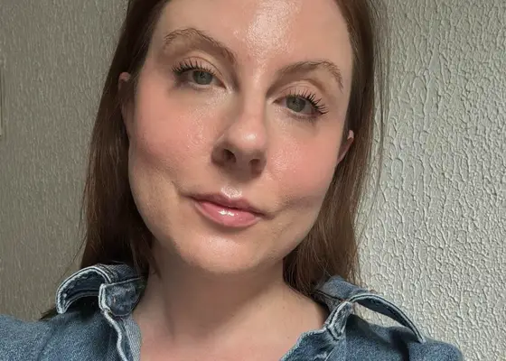 Ho provato il collo botox ed ecco i miei pensieri onesti