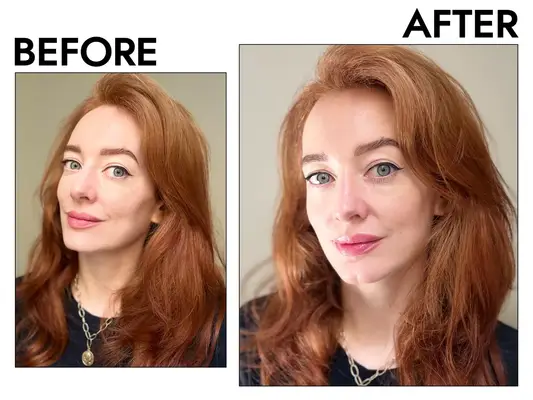 Sundays Skincare Before and After Application on Person
