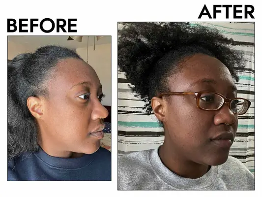 A before and after photo showing the effects of using BiorÃ© Deep Pore Charcoal Cleanser