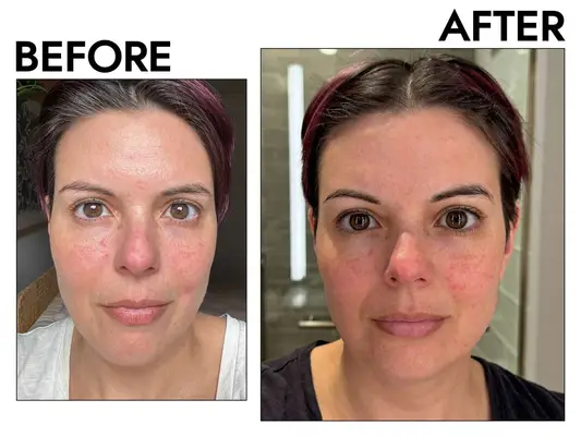 A person before and after using pixi Rose Cream Cleanser with Rose & Chamomile Flower
