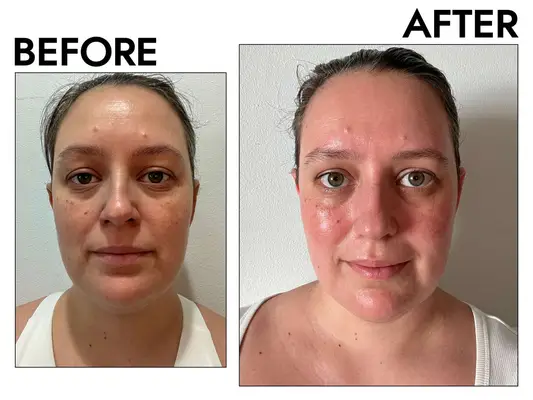 Cetaphil-pro-foaming-face-wash