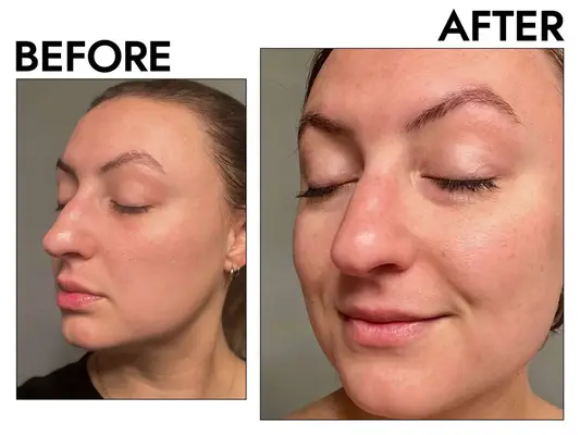 Amazon differin-daily-deep-cleanser