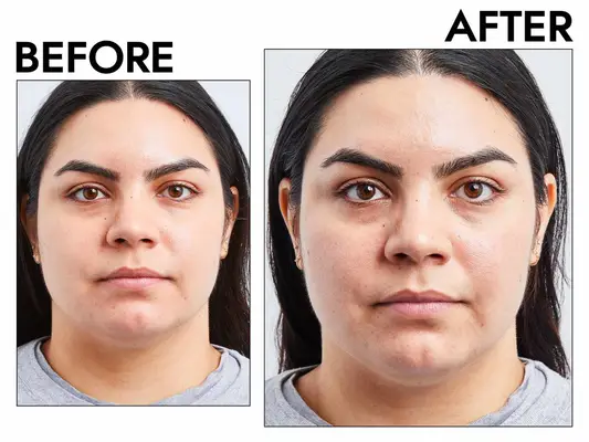 Photos of person’s face before and after using Eadem Cloud Cushion Plush Moisturizer