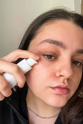 Ordinary Hydluronic Acid Before and After testing