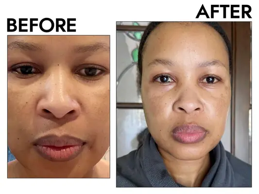 a tester before and after using L