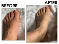 Before and after photos of a person