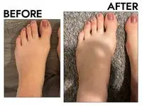 Before and after photos of person