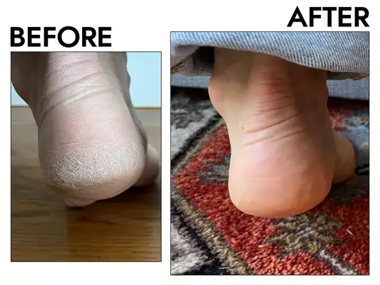 Amazon Aquaphor Advanced Therapy Repairing Foot Mask