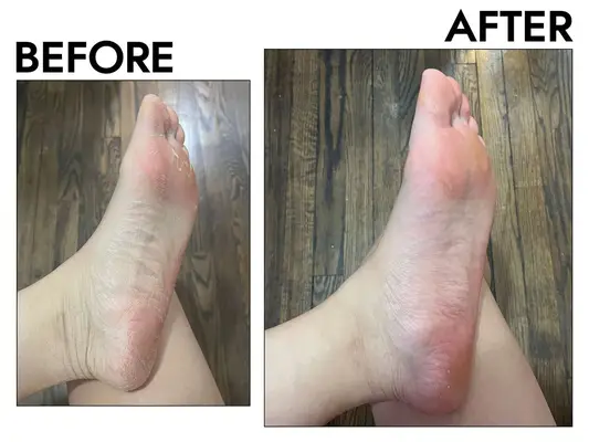 Before and after photos of a person