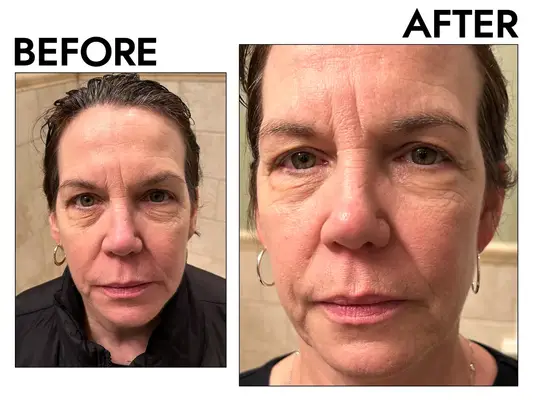 Sephora Skinfix Barrier+ Foaming Oil Cleanser