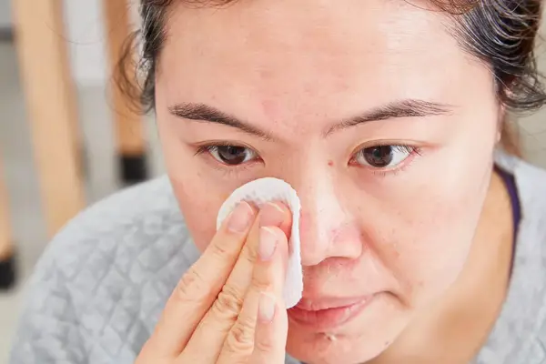 Person rubbing their face with a cotton round