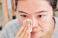 Person rubbing their face with a cotton round
