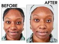 Two closeups of a person