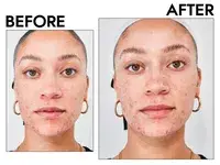 Two closeups of a person