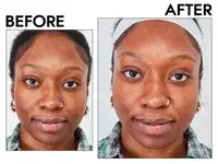 Two closeups of a person