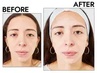 Two closeups of a person