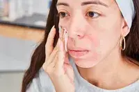 Person rubbing their cheek with a cotton round