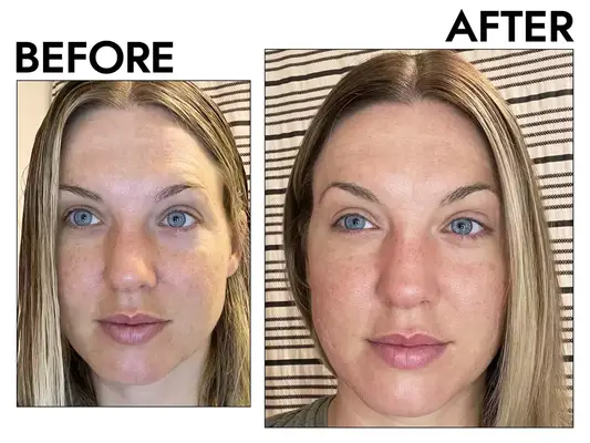 Collage of chemical peel products, including Peter Thomas Roth, Dr Dennis Gross, and Drunk Elephant, on a gray background