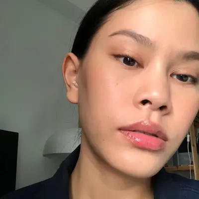 Como se livrar dos cravos no nariz, de acordo com os dermatologistas