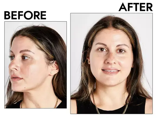 Photos of person’s face before and after using Herbivore Botanicals SUPER NOVA 5% Vitamin C + Caffeine Brightening Eye Cream