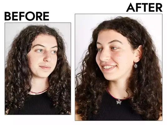 Photos of person’s face before and after using Lâncome Absolue Revitalizing Eye Cream