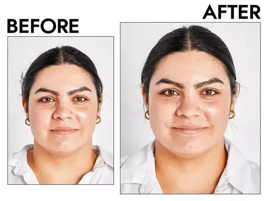Before and after The Inkey List Caffeine Eye Cream