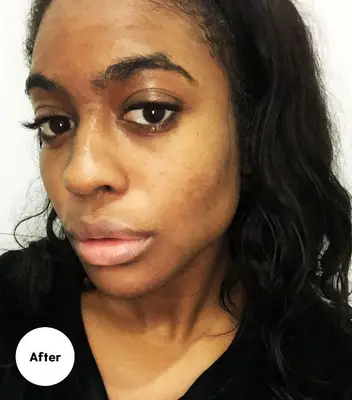 Skincare Routine for Dark Spots