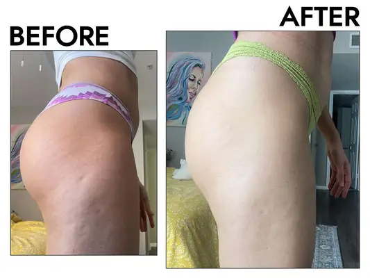 Revision Skincare BodiFirm Body Contouring Lotion