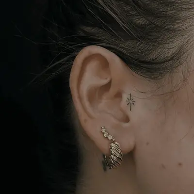 Star burst on the tragus of a woman