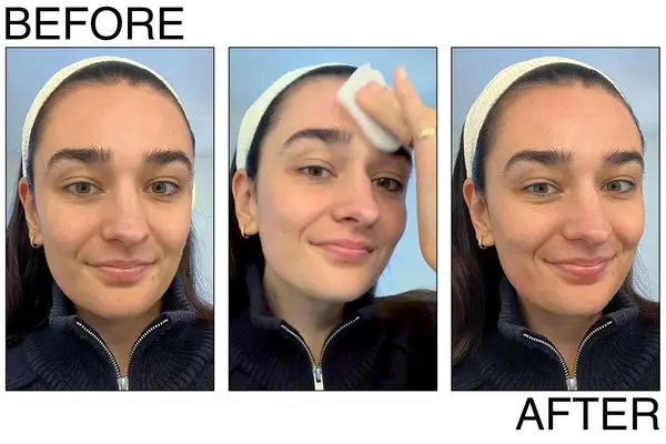 Neova 5-Second Daily Peel