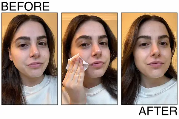 Person demonstrating the application of exfoliating pads on the face