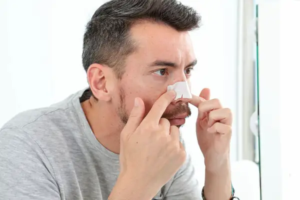 Starface Lift Off Pore Strips