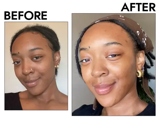 Before and after photos of Janiah McKelton using Naturium Vitamin C Serum