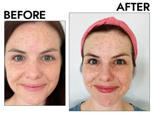 before and after photos of a person using the Yes To Grapefruit Daily Brightening Serum
