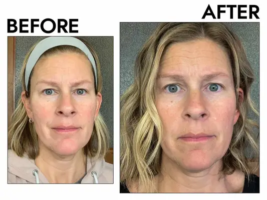 The Ordinary Lactic Acid 10% + HA