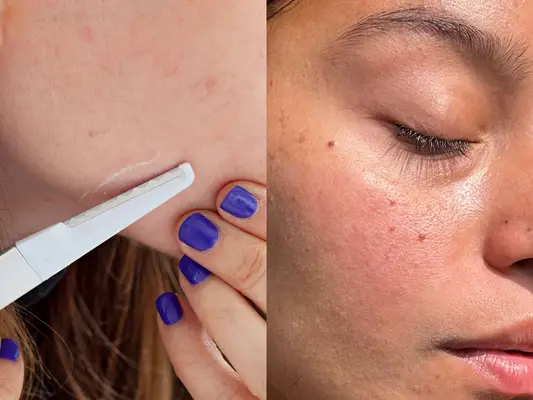 A dermaplaning tool shown being used and the results afterwards