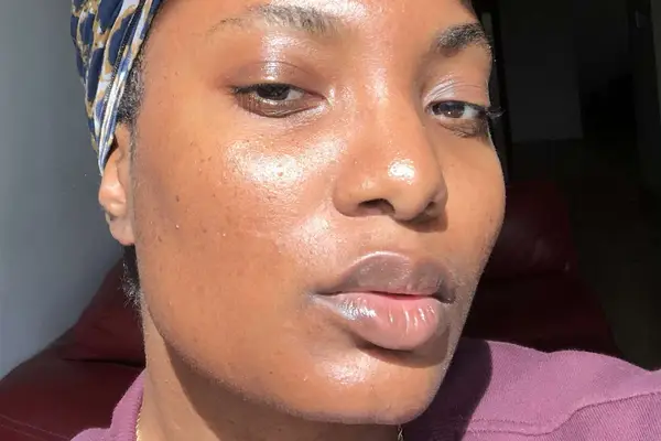 murad rapid dark spot correcting serum