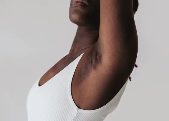 close up of woman with hyperpigmentation under arms
