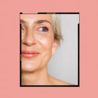 Tudo o que você precisa saber sobre o Excel V Laser Tratments