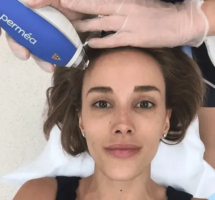 woman getting clear and brilliant laser treatment on face