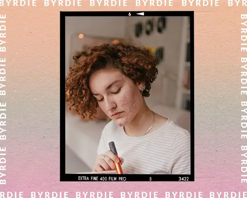 person with red curly hair and acne