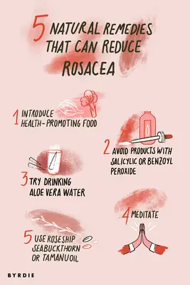 Natural Remedies for Rosacea