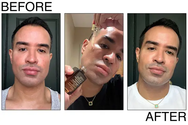 Two women applying anti-aging serums to their face