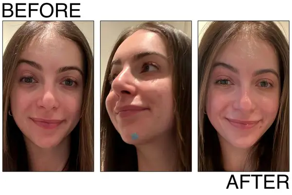 Hero Cosmetics Mighty Patch The Original