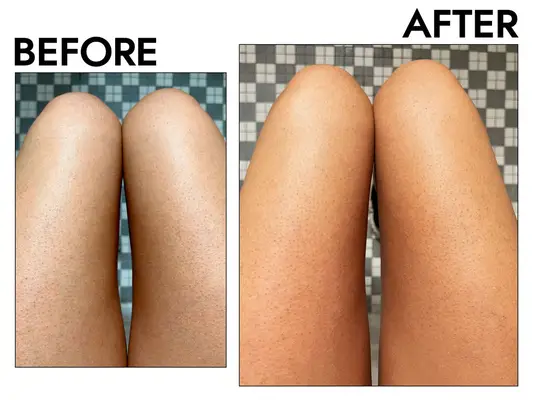 POPCHOSE Dry Brushing Body Brush before after