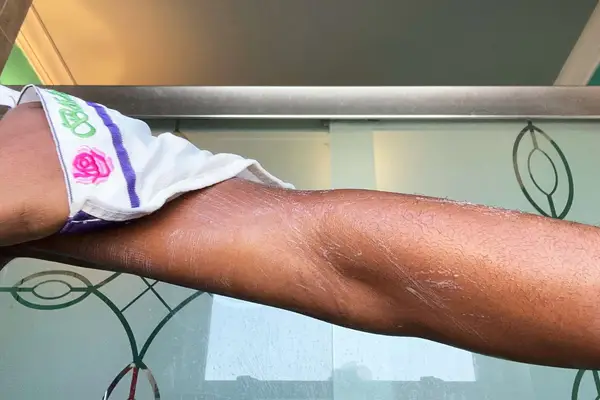 A person exfoliating with the Baiden Mitten Classic Mitten on their arm using soap